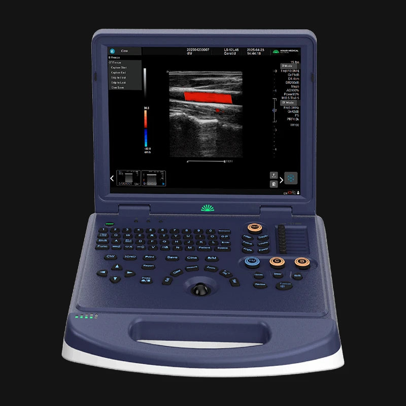 Hikari H30 - Portable Ultrasound with Color Doppler