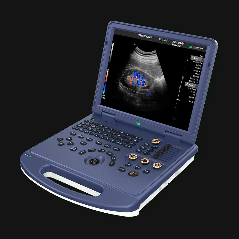 Hikari H30 - Portable Ultrasound with Color Doppler