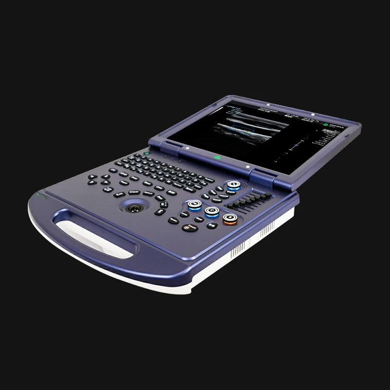 Hikari H30 - Portable Ultrasound with Color Doppler