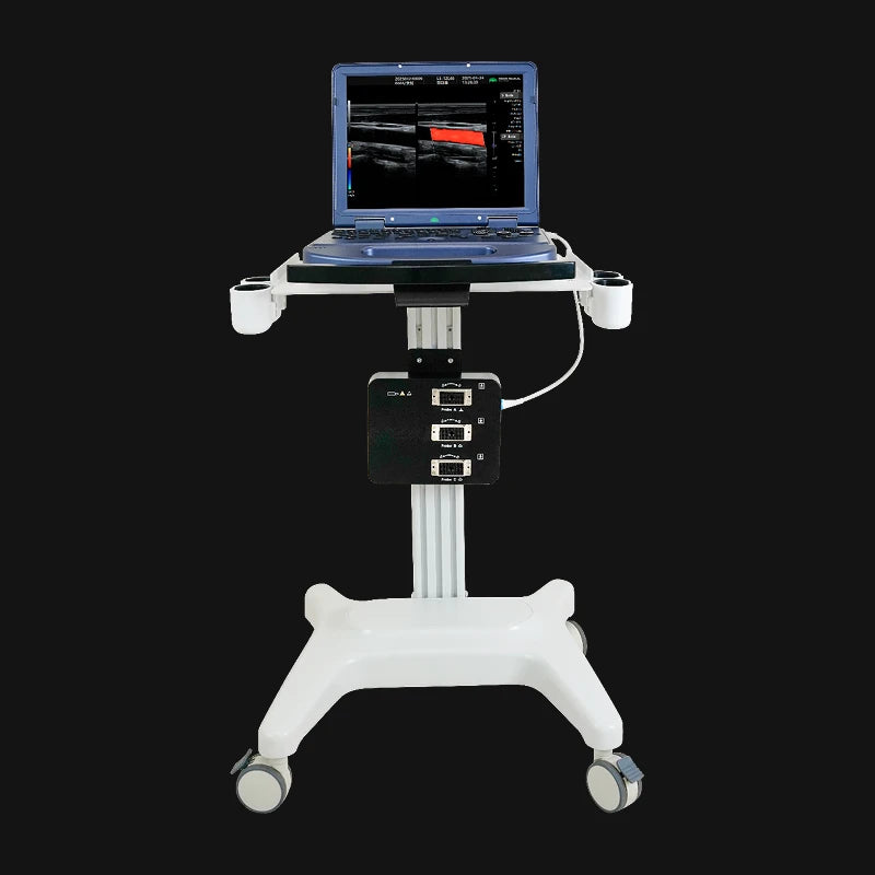 Hikari H30 - Portable Ultrasound with Color Doppler