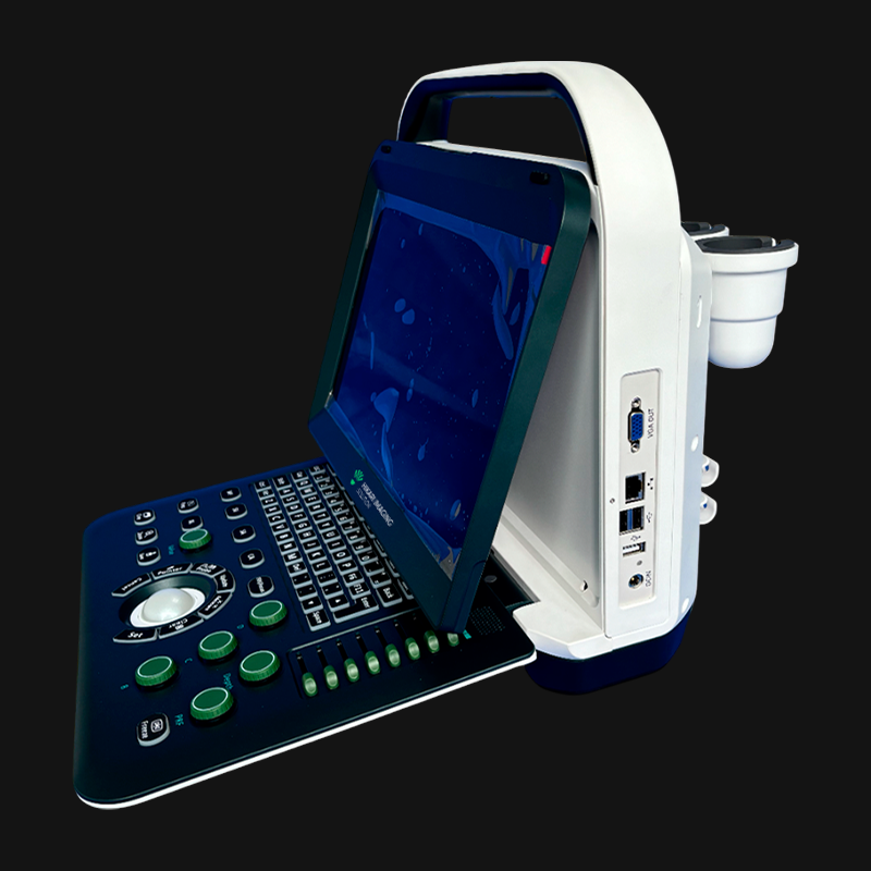 Hikari H50 - Portable Digital Ultrasound with Color Doppler