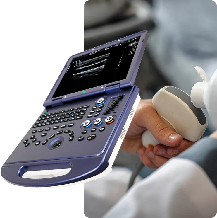 H30 Portable Color Doppler Ultrasound