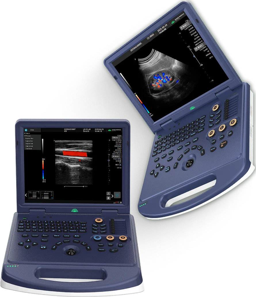 H30 Portable Color Doppler Ultrasound