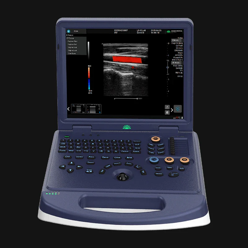 H30 Portable Color Doppler Ultrasound