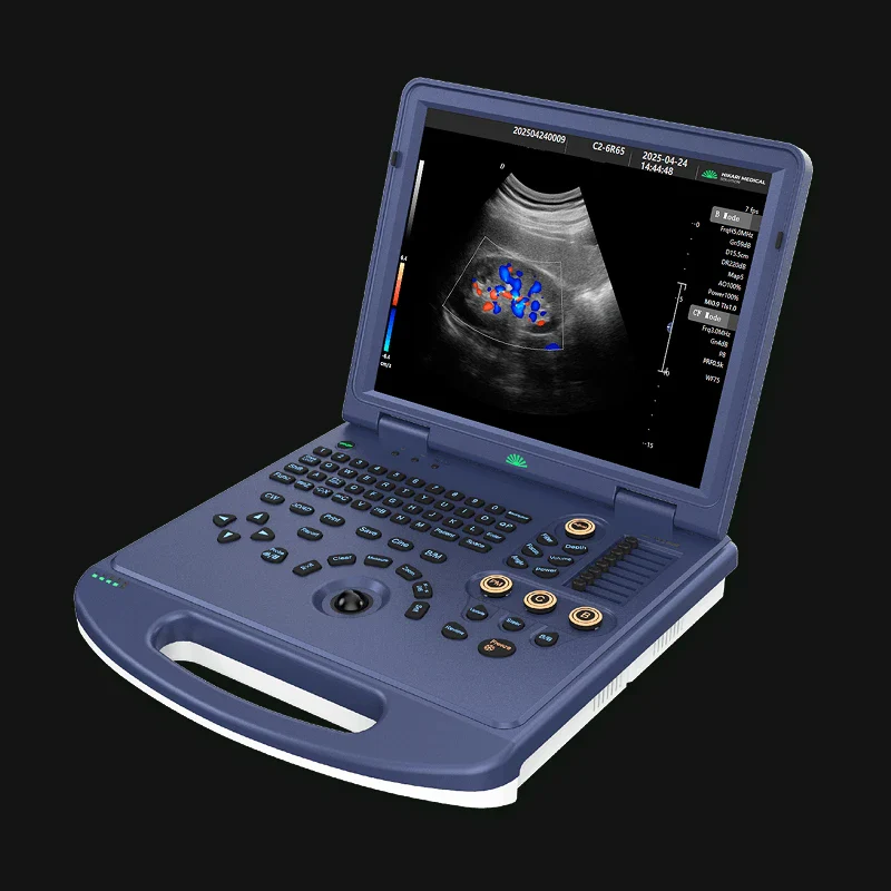H30 Portable Color Doppler Ultrasound 2