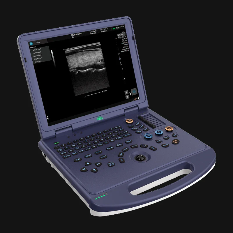 H30 Portable Color Doppler Ultrasound 3