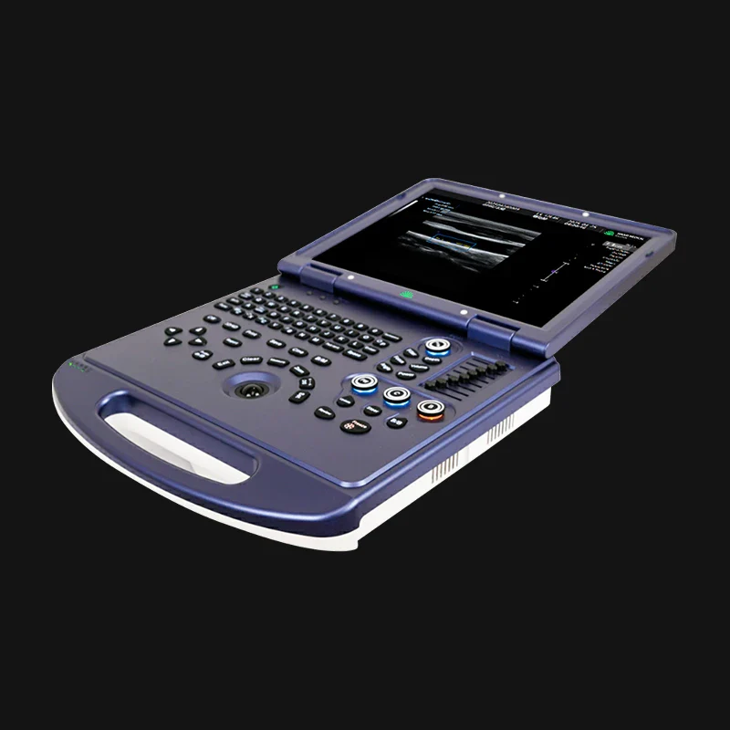 H30 Portable Color Doppler Ultrasound 4
