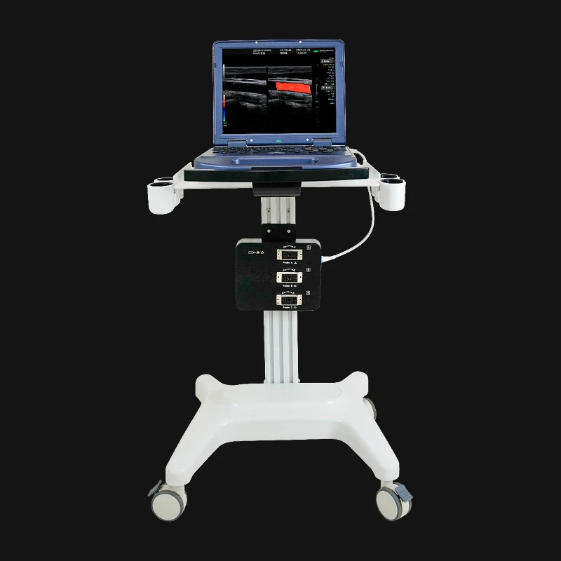 H30 Portable Color Doppler Ultrasound 5