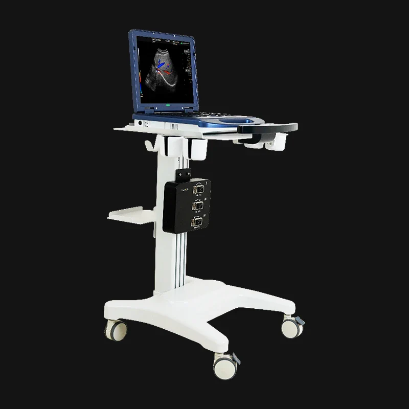H30 Portable Color Doppler Ultrasound 6