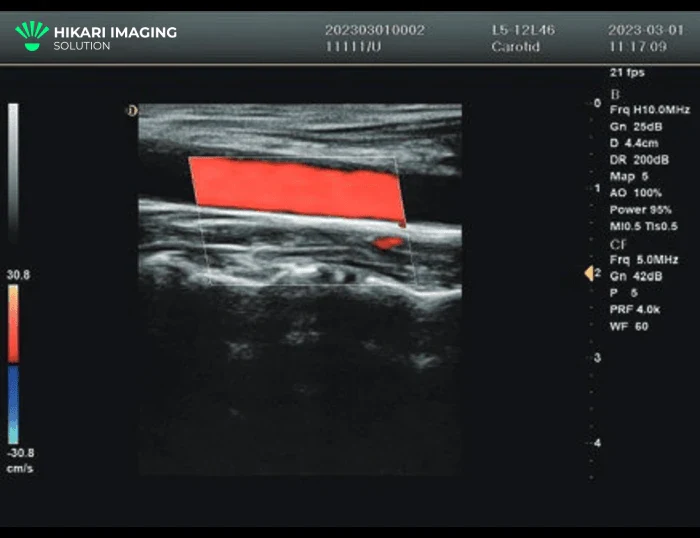 H30 Portable Color Doppler Ultrasound 1