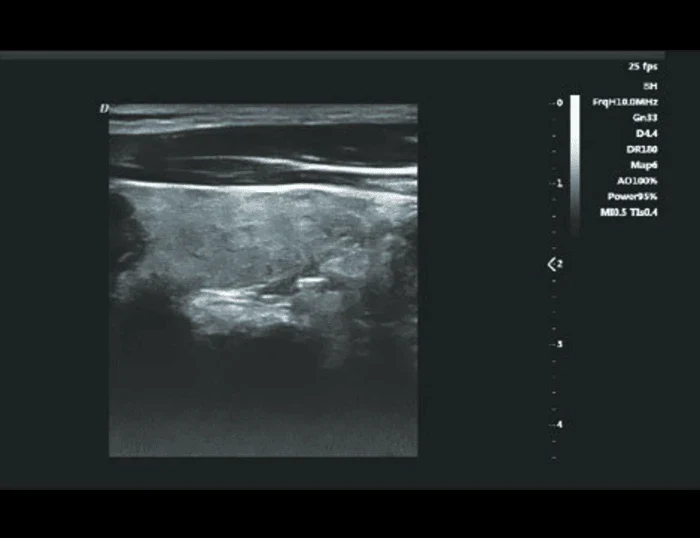 H30 Portable Color Doppler Ultrasound 2