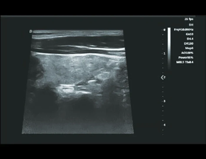 H30 Portable Color Doppler Ultrasound 3