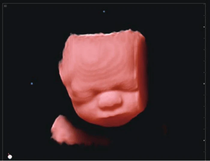 H30 Portable Color Doppler Ultrasound 5